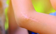 Cicatrici addio e i padri in sala parto: domani l'inserto
