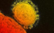 Cinque morti a Parma. I nuovi contagi sono 1.488