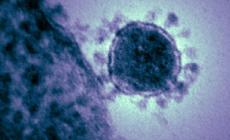 Cinque decessi (tra cui un 57enne) e 290 nuovi contagi a Parma nelle ultime 24 ore