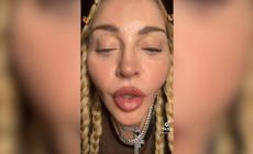 Troppi interventi estetici, la "metamorfosi" di Madonna:  la preoccupazione dei suoi fan