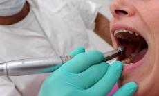 Tangenti su protesi e apparecchi dentali, 5 arresti tra Milano e Lodi