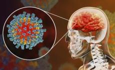 Long Covid: la nebbia nel cervello, sintomo simile all'Alzheimer