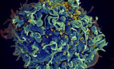 Via libera dell'Agenzia del farmaco: sarà gratuita la pillola contro il contagio da Hiv
