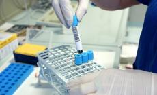 Allerta per l'epatite A: focolaio con 303 casi in 7 Paesi europei
