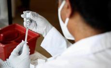 Il virus del vaiolo delle scimmie potrebbe annidarsi nei testicoli
