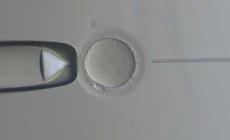 Bologna, incinta grazie ad ovociti congelati e donati 14 anni fa: prima volta al mondo in cui la fertilit&agrave; &egrave; conservata cos&igrave; a lungo 