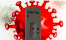 Covid, 3 decessi nell'ultima settimana. 263 i nuovi contagi