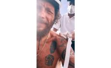 Brutta caduta per Jovanotti a Santo Domingo: &laquo;Temo di essermi rotto qualcosa&raquo;. Dovr&agrave; essere operato - Video