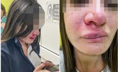 Infermiera trascinata per i capelli e colpita con pugno in viso