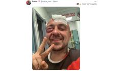 Chef Rubio aggredito, post sui social: "Mi hanno massacrato, sono terroristi"