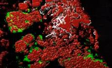 Pronto l'atlante 3D dei tumori, base per nuove terapie
