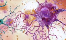 Alzheimer, speranze da uno spray nasale dopo test su animali