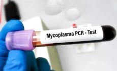 Malattia in Congo, fra le ipotesi anche una polmonite da Mycoplasma