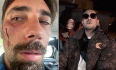 Diffamò Brumotti in un videoclip dopo un servizio di Striscia la Notizia: trapper condannato 