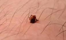 A 13 anni muore dopo morso di zecca, aperta inchiesta