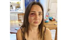 Viva per miracolo Gaia,  picchiata brutalmente dal suo ex che ha anche tentato di ucciderla: le sue parole - Video