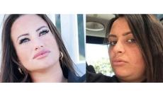 Morta in ospedale a Napoli la donna ferita dalla compagna 