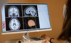 Parma, nuove prospettive per la depressione resistente