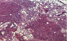 Il grasso beige &egrave; amico dei vasi sanguigni, abbassa la pressione