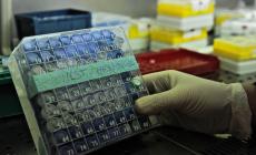 Donna muore a Pescara a causa di una meningite fulminante