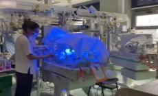 Torino: tumore nel cuore, neonato operato durante parto