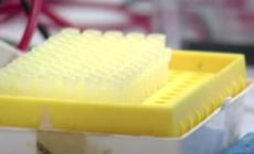 Scoperto un nuovo gene responsabile dell'autismo