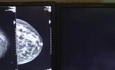 Torna a salire la spesa privata per le cure: +9% nel 2021
