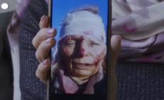 Ucraina, parla Olena Kourilo: protagonista della prima foto simbolo della guerra