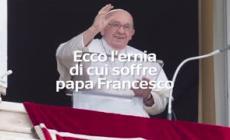 Ecco l'ernia di cui soffre papa Francesco