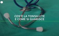 La tonsillite di Sinner, cosi' frequente fra i bimbi