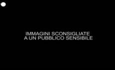 Giornalisti russi feriti durante un bombardamento in Libano