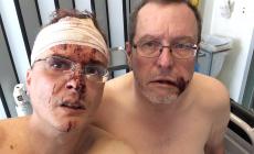 Aggressione omofoba a un fumettista italiano e al marito 