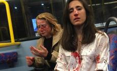 Lesbiche rifiutano di baciarsi sul bus, picchiate da omofobi