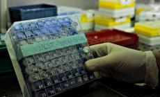 "Meningite? Troppo allarme. I casi non sono aumentati"