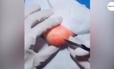  Il 'chirurgo della frutta' sbanca su Internet - Video