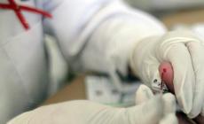 Aids: in farmacia test per autodiagnosi Hiv