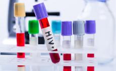 Nasconde di essere malato di Hiv e contagia quattro donne, muore la sua ex compagna