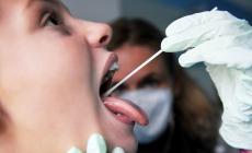Forte aumento dei casi di scarlattina dopo lo stop da Covid
