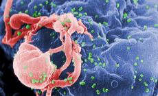Contagiò la moglie con l'Aids, a processo per lesioni: rischia sino a 12 anni