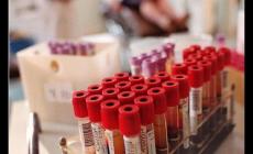 Sei immune al Covid? Un nuovo test rapido lo misurerà in meno di 24 ore