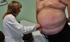 Scoperta nei topi una delle chiavi per ridurre l'obesità 