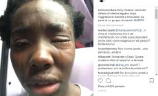 Lancio di uova contro Daisy, campionessa italiana: lesioni all&rsquo;occhio: &laquo;Volevano colpire una ragazza di colore&raquo;