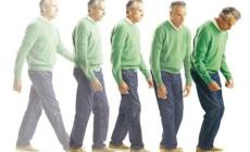 Si arruolano gemelli per capire meglio il Parkinson