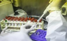 Primo caso di vaiolo delle scimmie in Italia.  Forse altri due casi. Iss: "Prudenza nei rapporti stretti o sessuali" - La malattia