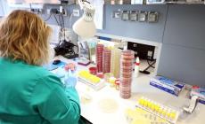 Infettivologo del Sacco: 'Non solo gli anziani, anche dei giovani sono molto gravi' - SINTOMI E DUBBI, COSA FARE (Vademecum)