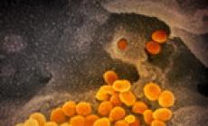 Coronavirus, il mix di antivirali per l'Aids fallisce