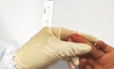 Test rapido del sangue per riscontrare il covid 19 e limitare i contagi - Video