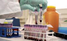 Epatite C, da Parma il ricorso per avere farmaci