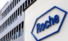 Roche, messo a punto un nuovo test sierologico
