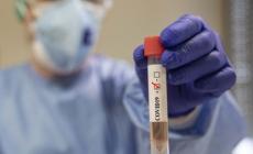Coronavirus, allo Spallanzani isolato nelle lacrime di una paziente